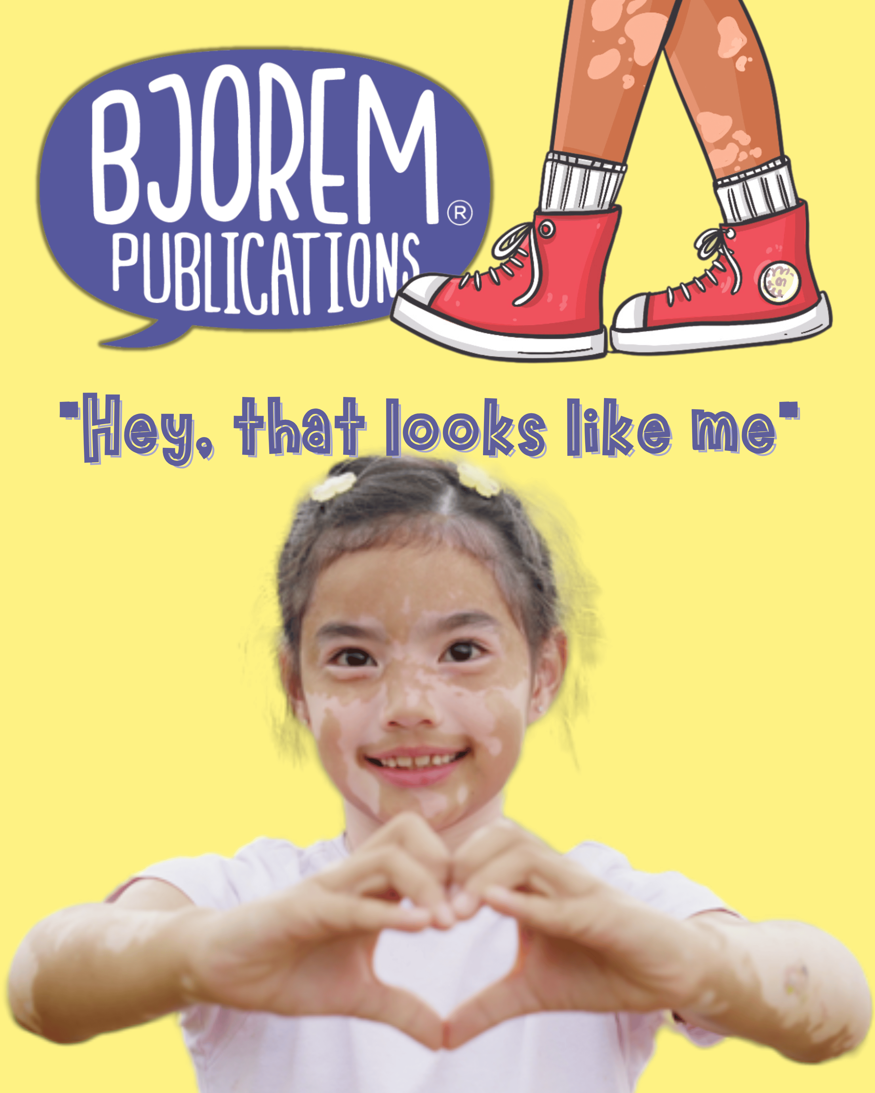 Girl with vitiligo making heart shape, looks like me