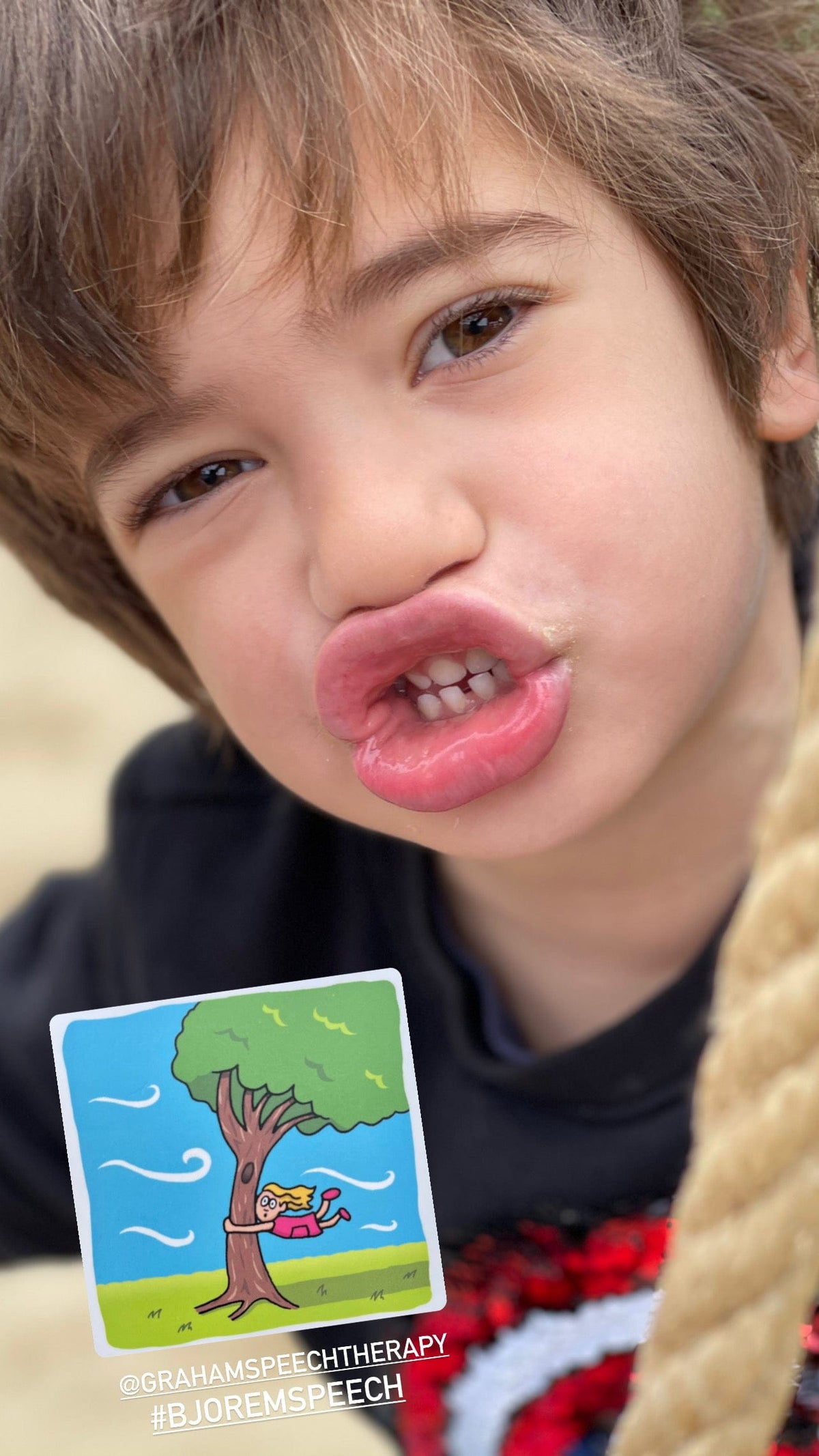 Child with a funny face, holding speech therapy card.